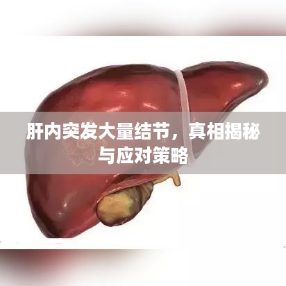 肝内突发大量结节，真相揭秘与应对策略