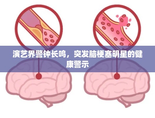 演艺界警钟长鸣，突发脑梗塞明星的健康警示