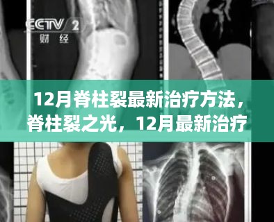 12月脊柱裂最新治疗方法突破，引领康复新时代