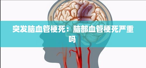 突发脑血管梗死：脑部血管梗死严重吗 