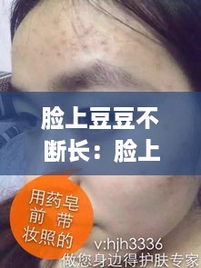 脸上豆豆不断长：脸上豆豆反复长 怎么办 