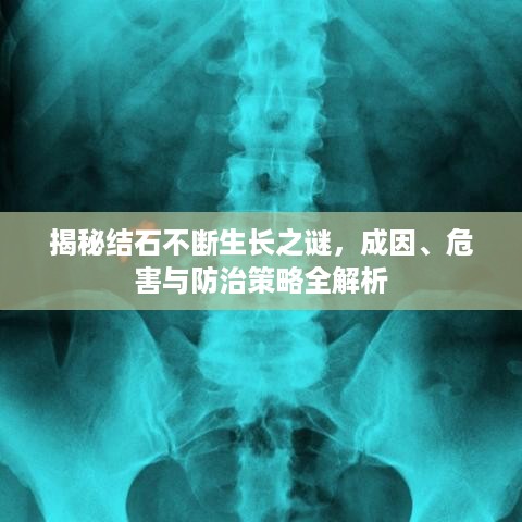 揭秘结石不断生长之谜，成因、危害与防治策略全解析