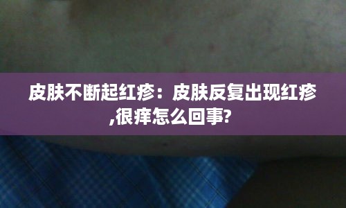 皮肤不断起红疹：皮肤反复出现红疹,很痒怎么回事? 