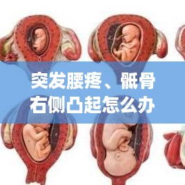 突发腰疼、骶骨右侧凸起怎么办？症状解析及应对妙招