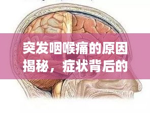 突发咽喉痛的原因揭秘，症状背后的真相解析