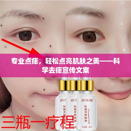 专业点痣，轻松点亮肌肤之美——科学去痣宣传文案