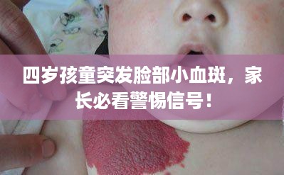 四岁孩童突发脸部小血斑，家长必看警惕信号！